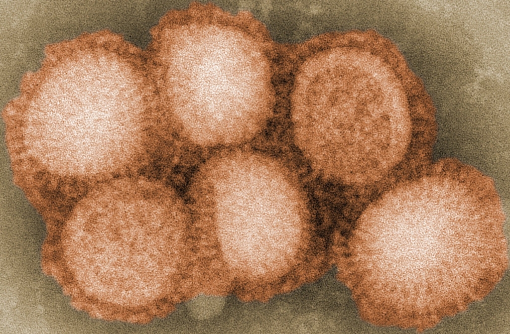 Colorized negative stained transmission electron micrograph (TEM) depicted some of the ultrastructural morphology of the A/CA/4/09 swine flu virus. (credit: C. S. Goldsmith and A. Balish, CDC)